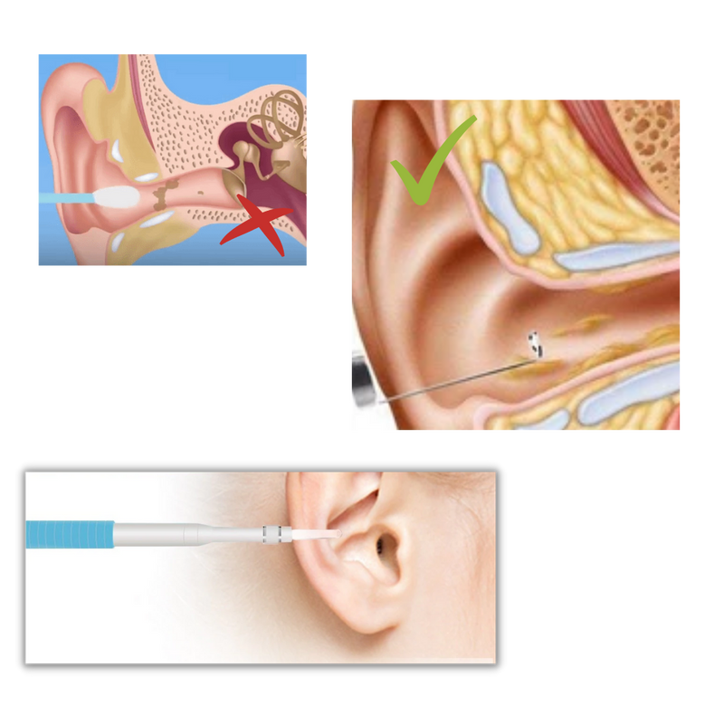 3 in 1 Ohrkamera