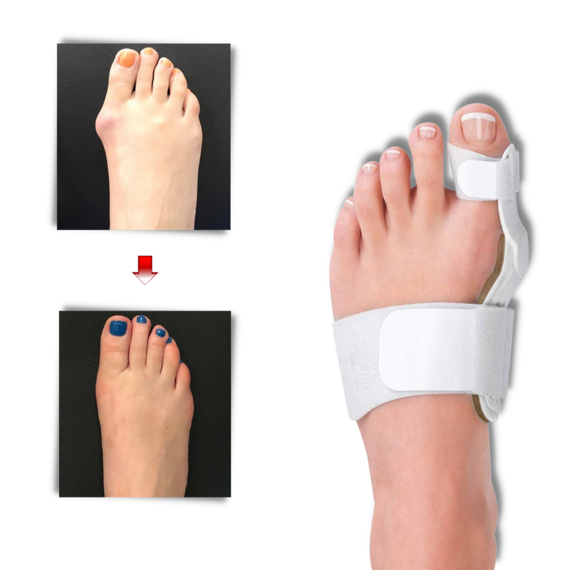 Orthopädischer Ballenzeh-Korrektor