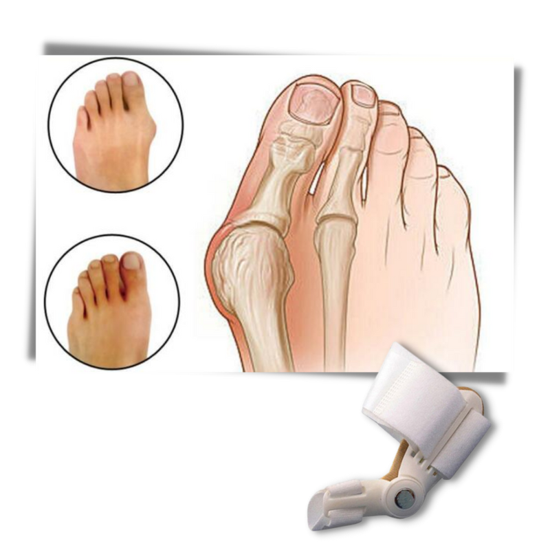 Orthopädischer Ballenzeh-Korrektor