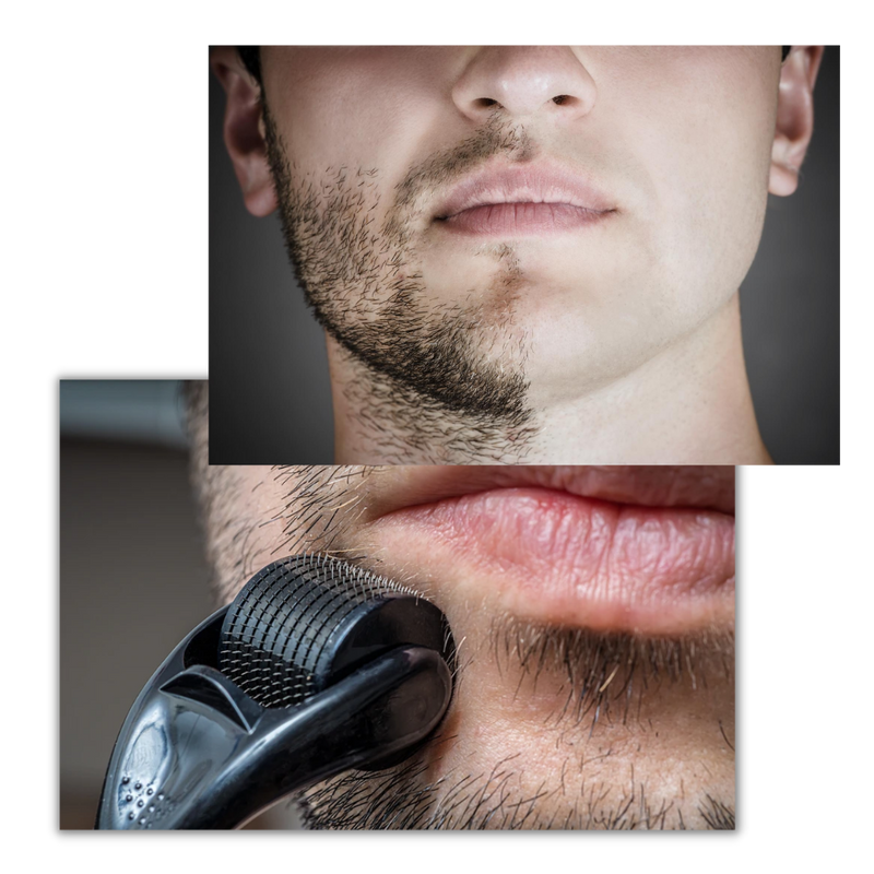 Derma-Roller für Haar- und Bartwuchs