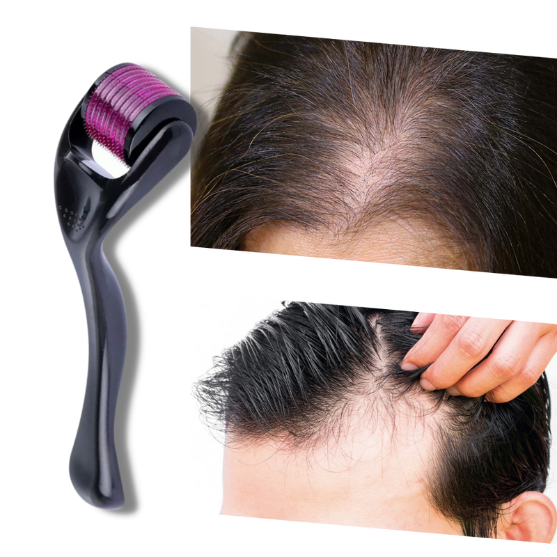 Derma-Roller für Haar- und Bartwuchs