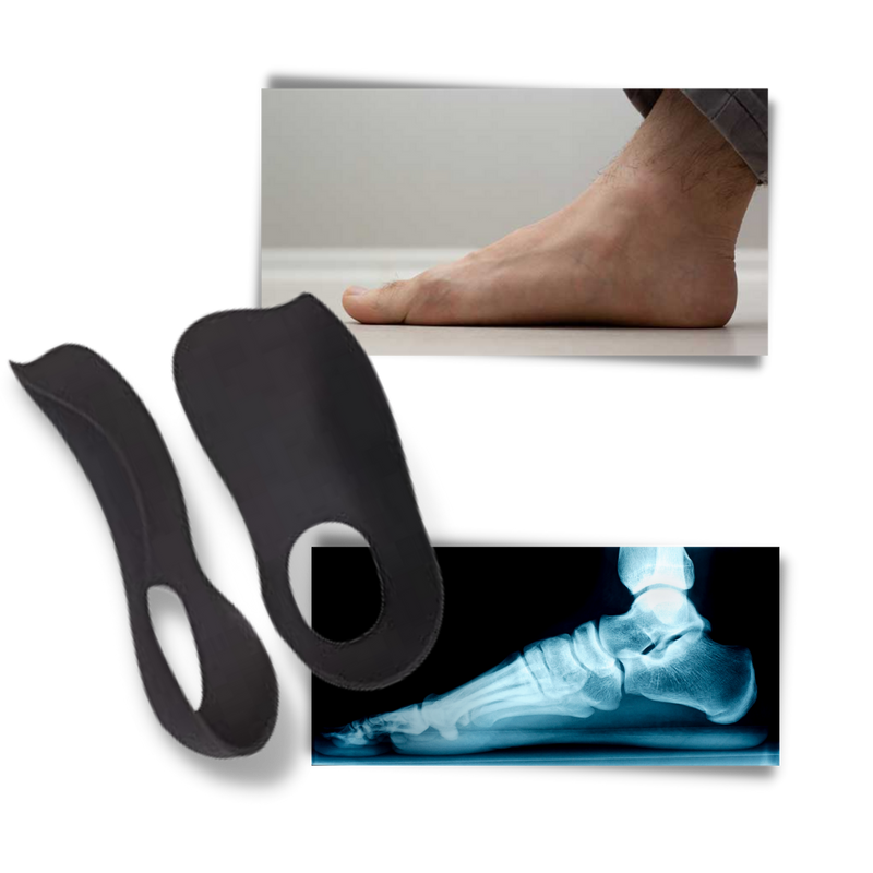 Orthopädische Einlagen für Plattfüße
