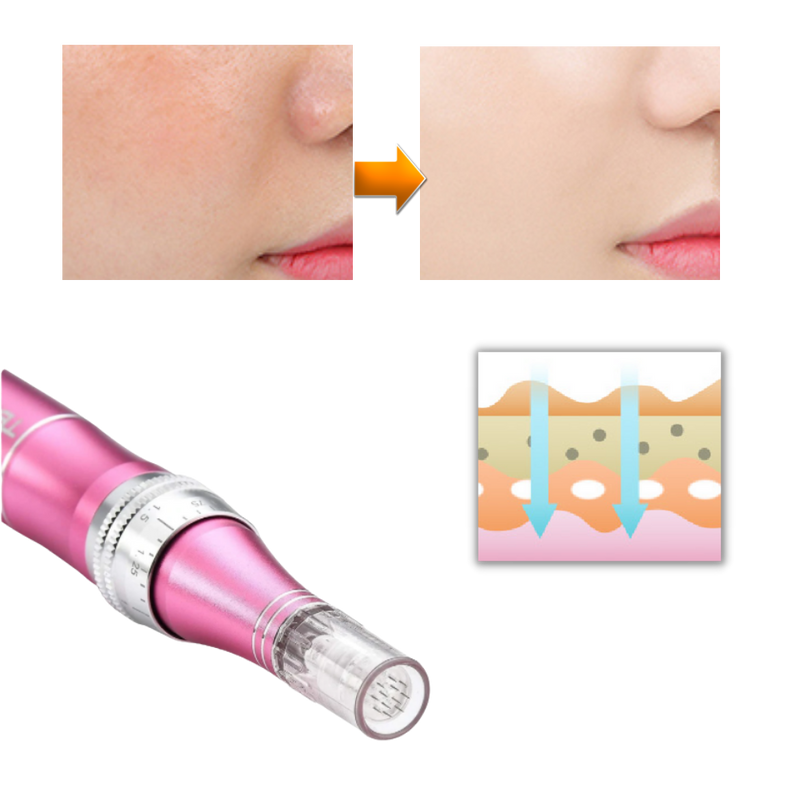 Dermal Microneedling Stift