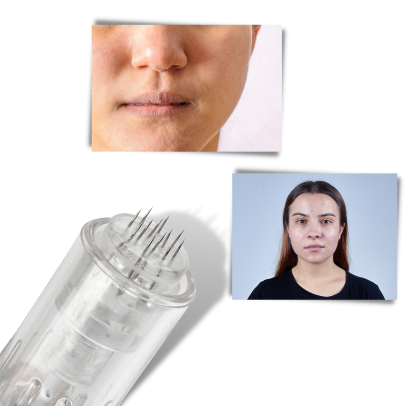 Dermal Microneedling Stift