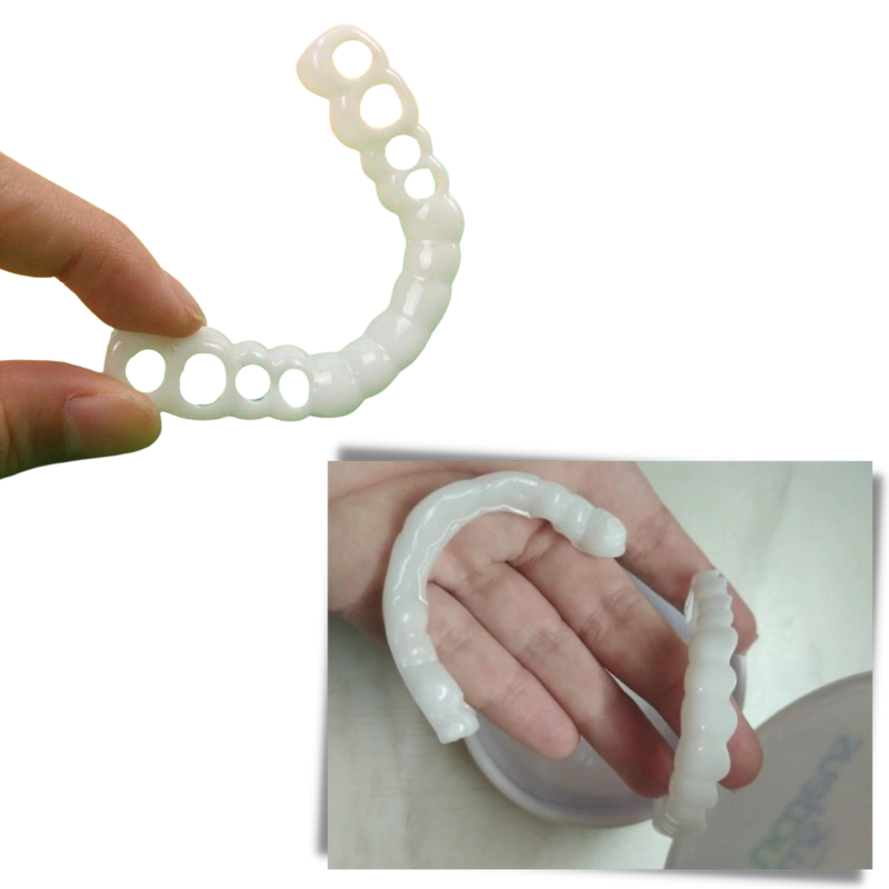 Perfektes Lächeln - komfortable Verblendschalen
